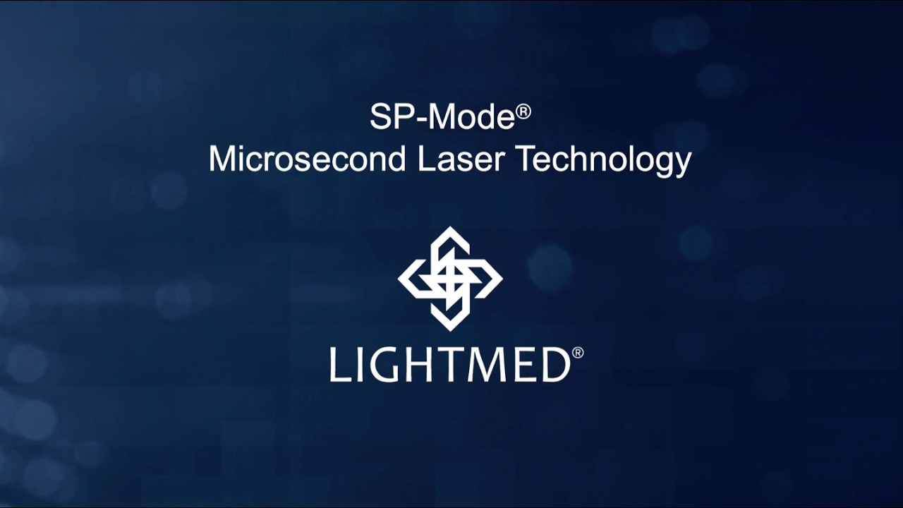SP-Mode® Microsecond Laser Technology video