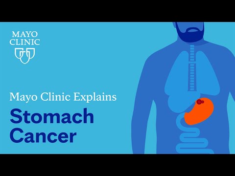 Mayo Clinic explains stomach cancer
