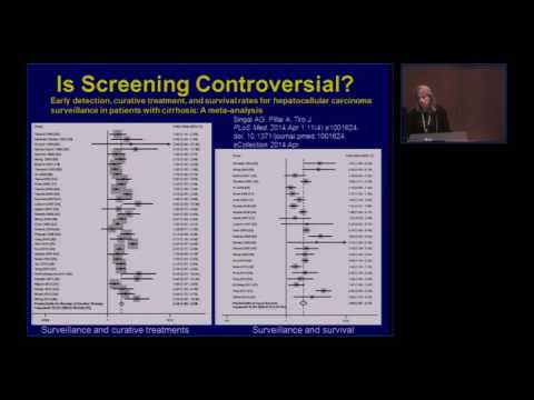 Multidisciplinary Management of Hepatocellular Carcinoma (HCC)