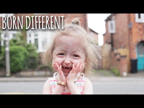 Little Hero: The Girl Living With Benjamin Button Disorder
