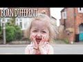 The Only Girl In The World With 'Benjamin Button' Disease | BORN DIFFERENT