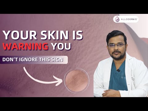 Allodermis featured video
