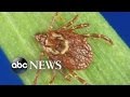 Rocky Mountain Spotted Fever Cases Could Be on the Rise
