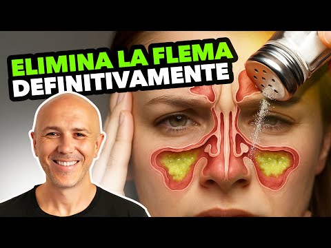 Esta Es La Verdadera Razón Por La Que Tienes FLEMA En La GARGANTA Y Así La Puedes ELIMINAR