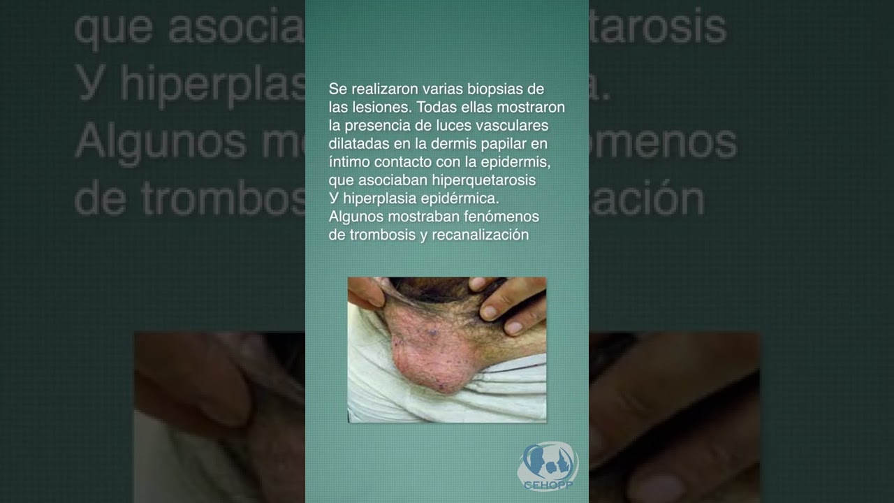 Juan Carlos Villalobos Olivera-14