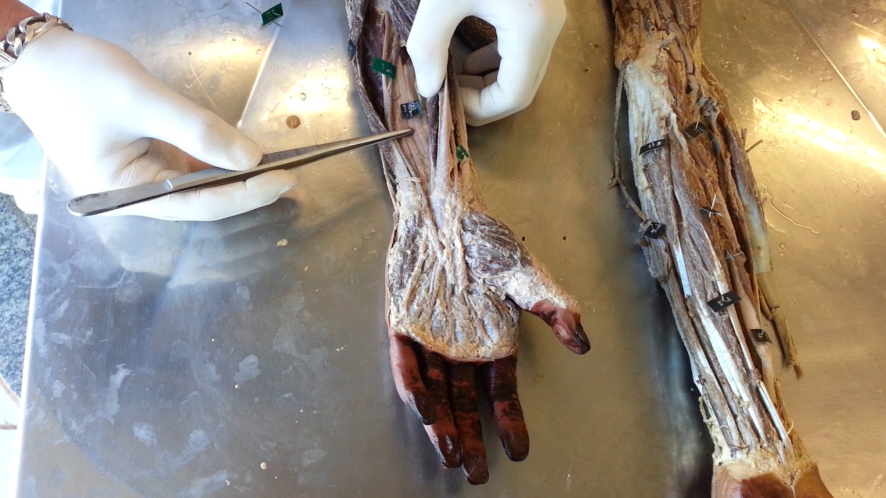 VÍDEO AULA MÚSCULOS DE MEMBRO SUPERIOR