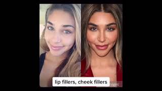Chantel Jeffries' various Cosmetic Procedures #shortsviral #shorts#shortsvideo