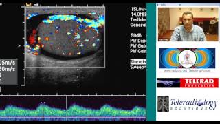 preview picture of video 'Ultrasound of Acute Epididymo Orchitis by Dr Arjun Kalyanpur'