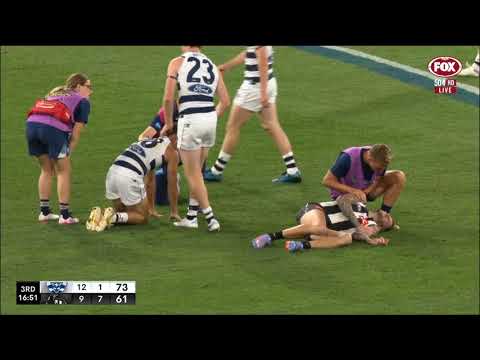 Jeremy Howe BROKEN ARM!