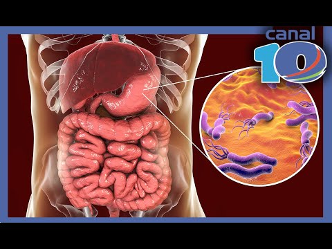 Osteocondrosi della colonna cervicale vertigini Forti dolori alle articolazioni delle mani per aiutare