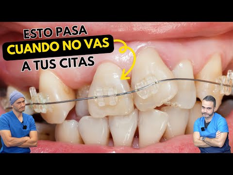 Nunca dejes de ir a tus citas dentales 😱