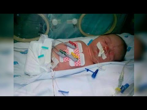 Le bébé né sans bras ni jambes,les médecins lui ont donné une heure à vivre ont la bouche ouverte😲 Video