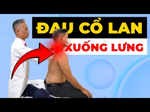 Dân Văn Phòng Bị Đau Cổ Lan Xuống Lưng: Nguyên Nhân Và Cách Khắc Phục Ngay