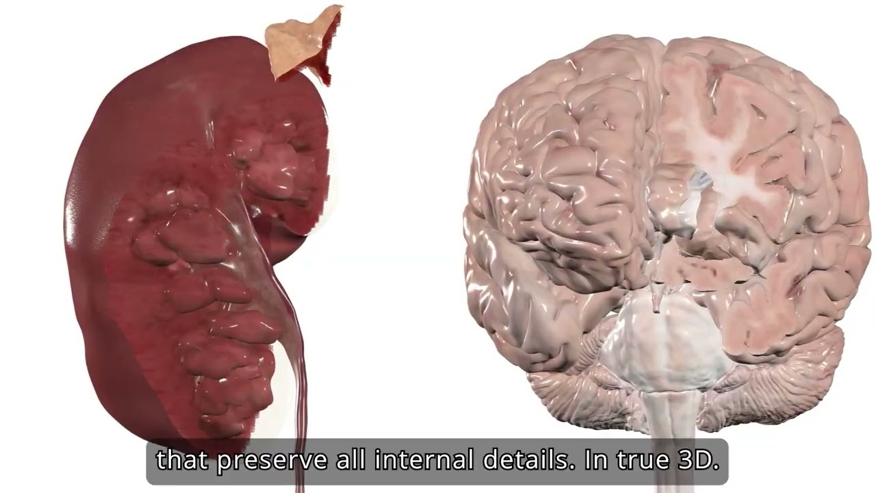 A New Generation of 3D Anatomy Models Based on Real Human Data | Anatomage