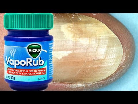 Bumili ng gamot mula sa mga halamang-singaw Selisilik pamahid na may halamang-singaw sa kuko