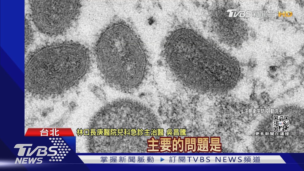 「猴痘」傳播率跟各新冠病毒株比較!致死率最高10%