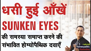 धंसी हुई आँखें  || Sunken Eyes || Natural homeopathic remedies with symptoms ...