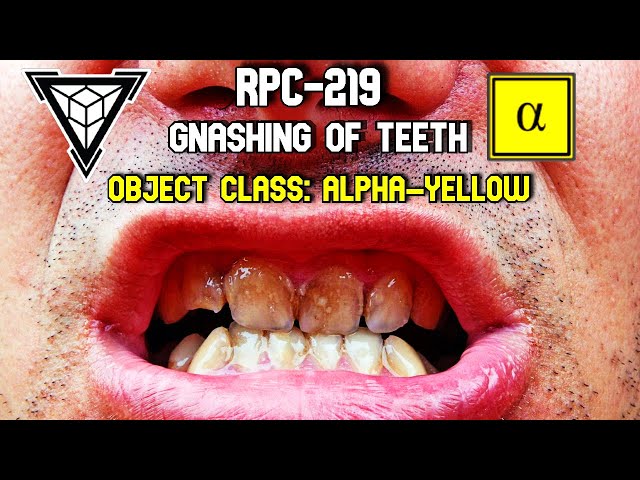 Video Pronunciation of gnashing in English Video Pronunciation of gnashing in English