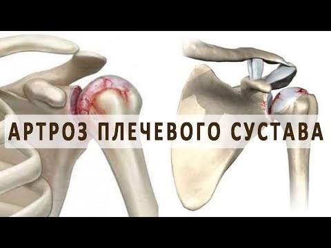 Компресс медовый от боли в суставах Боли в боку пояснице