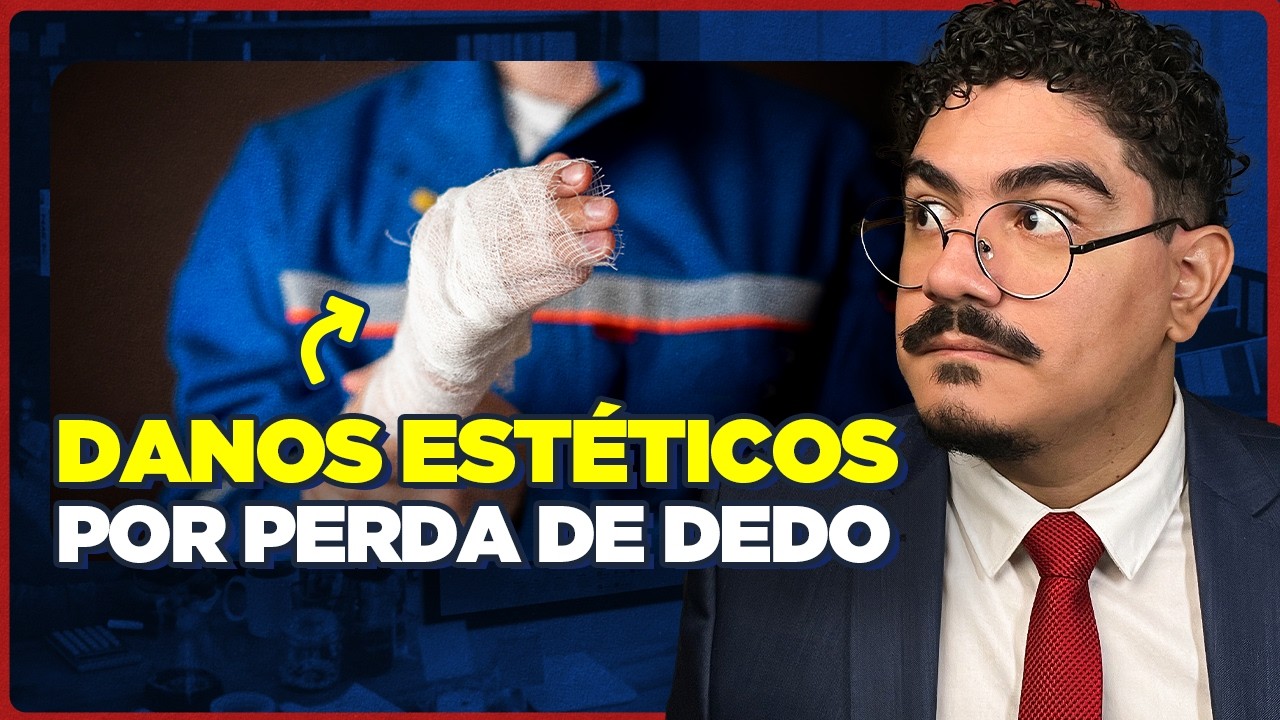 Dano Estético por Perda de Dedo no Trabalho: Saiba QUANTO e Quando você pode RECEBER (2025)