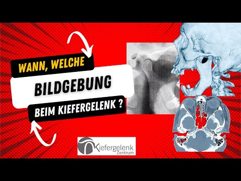 Röntgen, Ultraschall oder MRT beim Kiefergelenk?