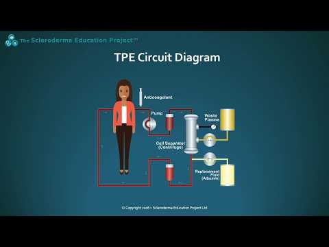 download lagu mp3 mp4 Apheresis Pdf, download lagu Apheresis Pdf gratis, unduh video klip Apheresis Pdf