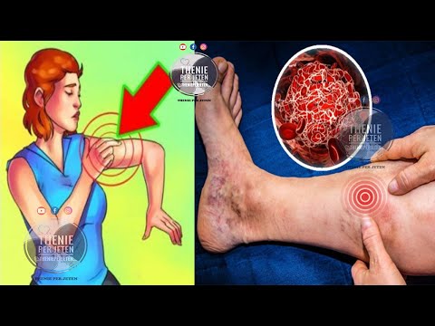 Mos i injoroni: Ja shenjat që jep trupi juaj para se te pesoni trompoze