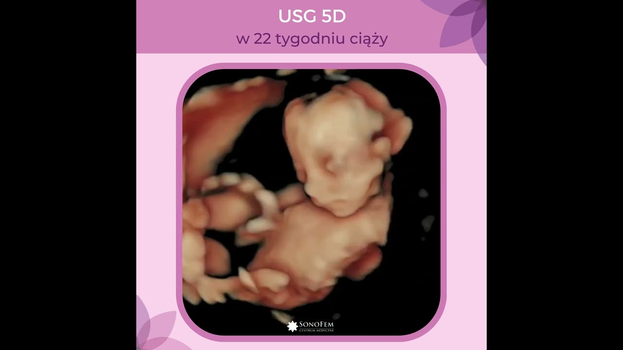 Anita Hamela-Olkowska-8