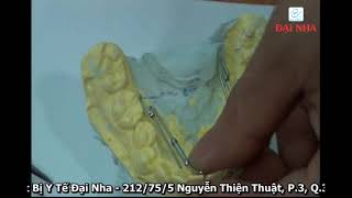 KHÍ CỤ NONG RỘNG HÀM TRANSFORCE- HƯỚNG DẪN KÍCH HOẠT