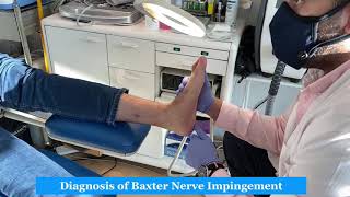 Baxter’s Nerve Diagnosis for Heel Pain