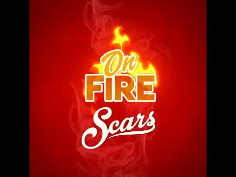 Scars LH - On Fire (Lyrics Video Officiel)