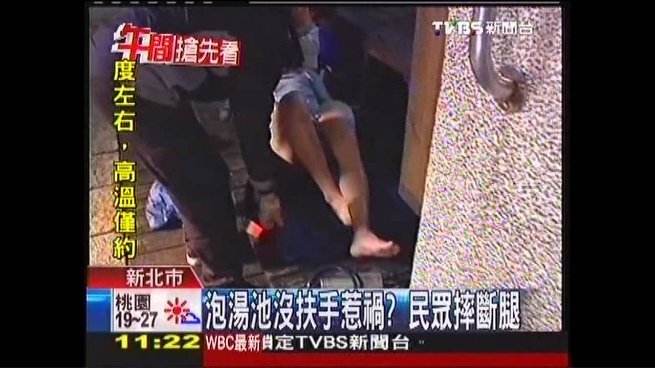 泡湯池沒扶手惹禍？　民眾摔斷腿