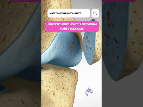 Guess The Spine Injury And Procedure Challenge
