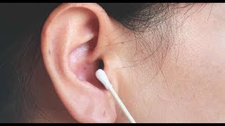 How to Stop and Prevent Your Ears from Ringing After a Concert