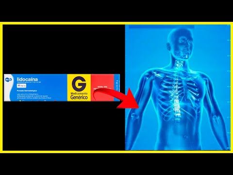 Vídeo: Lidocaína: para que serve e dúvidas frequentes