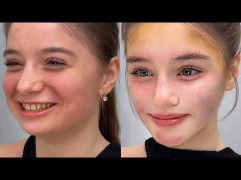 instant facial sculpting procedure 💉9D facial correction ⊹ reconstruction [exp] ୨୧