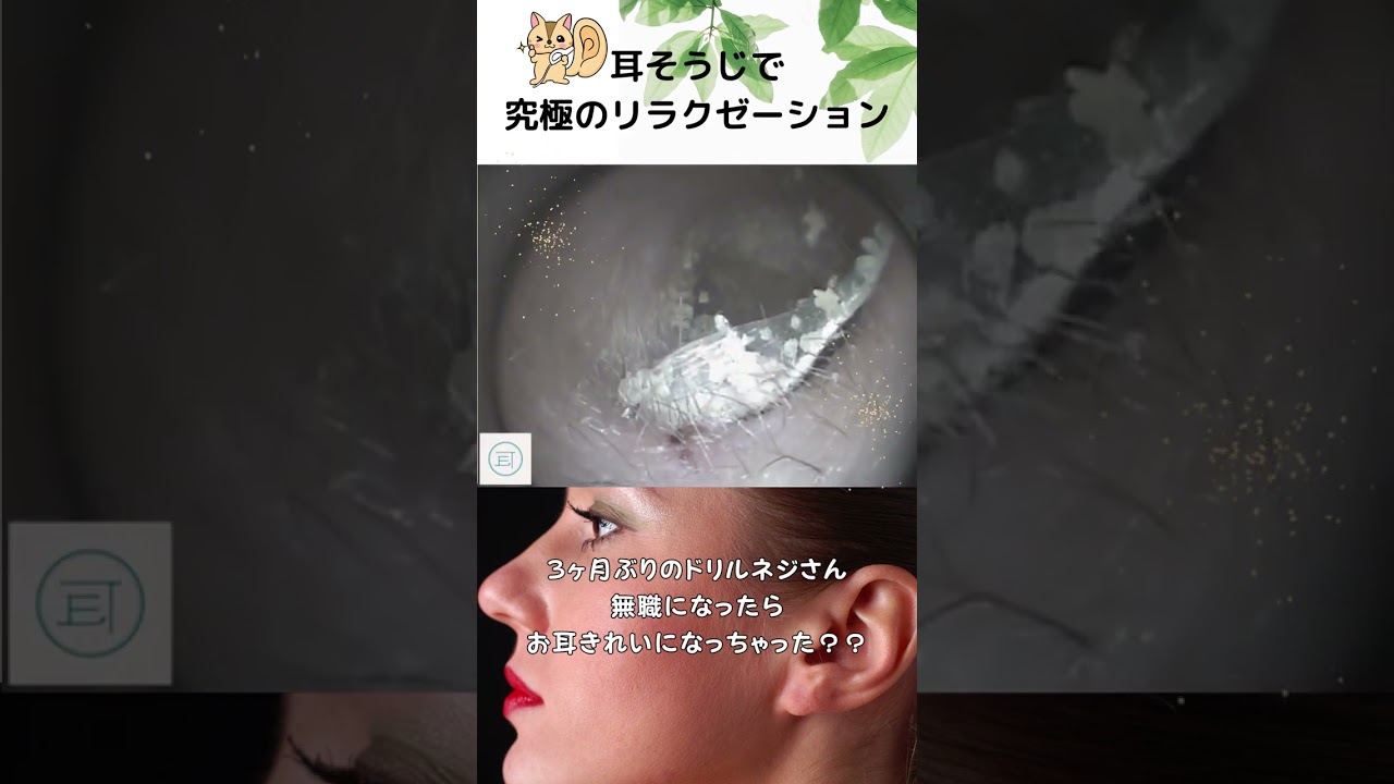 【耳掃除】3ヶ月ぶりのドリルネジさん　無職になったらお耳きれいになっちゃった？？  #イヤーエステ #耳掃除 #eariss #イヤーエステ #耳掃除 #耳かき動画