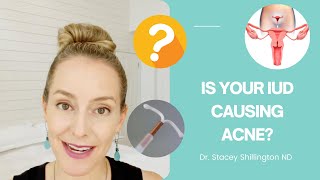 Is IUD the source of your acne?