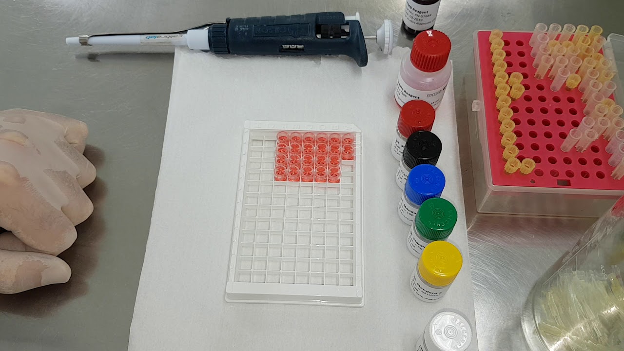IMUNOLOGIA - Aula prática ELISA (parte 1)
