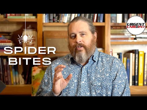 What are the Most Common Types of Spider Bites?