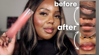 Instantly Brighten Your Lips With This One Product #darklipstreatment