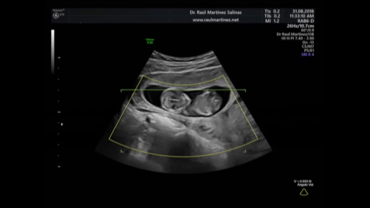 Raúl Martínez Salinas-7