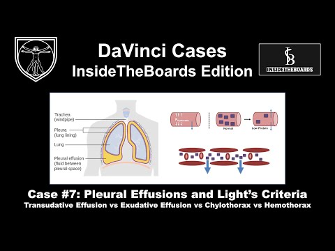 Pleural Effusions and Light's Criteria [DaVinci Cases - InsideTheBoards Edition Case 7]
