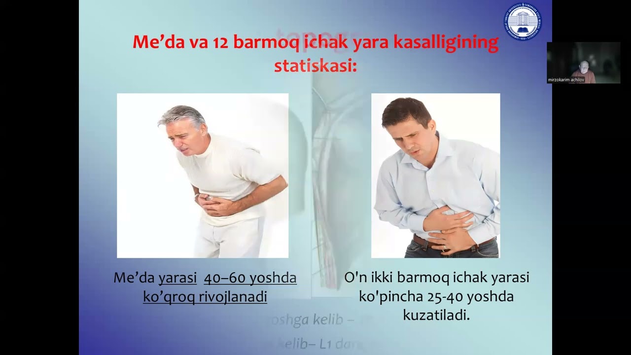Oshqozon va o'n ikki barmoqli ichak yara kasalligining zamonaviy diagnostikasi va xirurgik davolash
