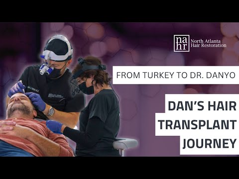 Dan’s Hair Transplant Journey From Turkey to Trusting Dr  Danyo