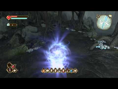 Fable: Anniversary Part 35 | No Love For Minions