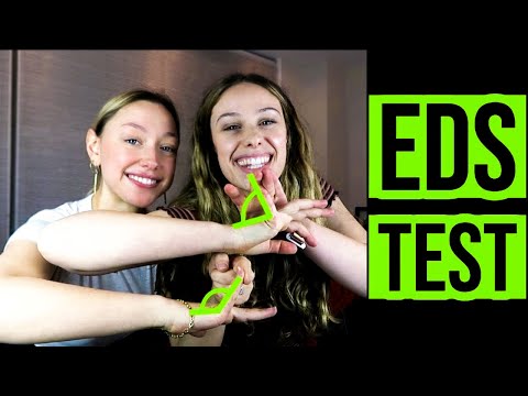 Ehlers-Danlos Test On EDS vs. Non-EDS Person