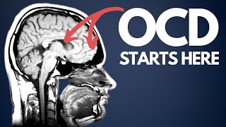OCD explained for beginners - how I wish I was taught