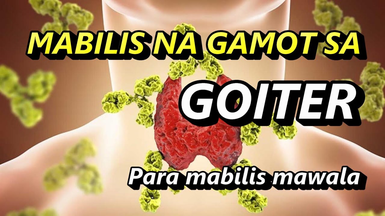 MGA HALAMAN GAMOT PARA SA GOITER, MADALI LANG PALA GAMUTIN ANG GOITER, ONE WEEK LANG