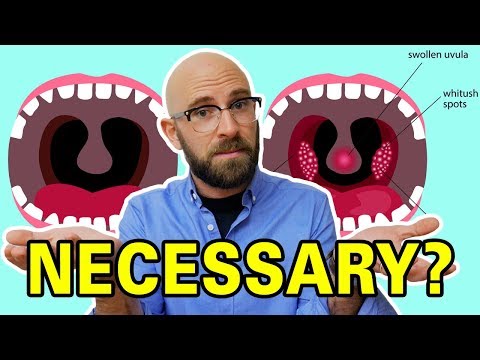 What Do Tonsils Actually Do and Why are We Constantly Removing Them